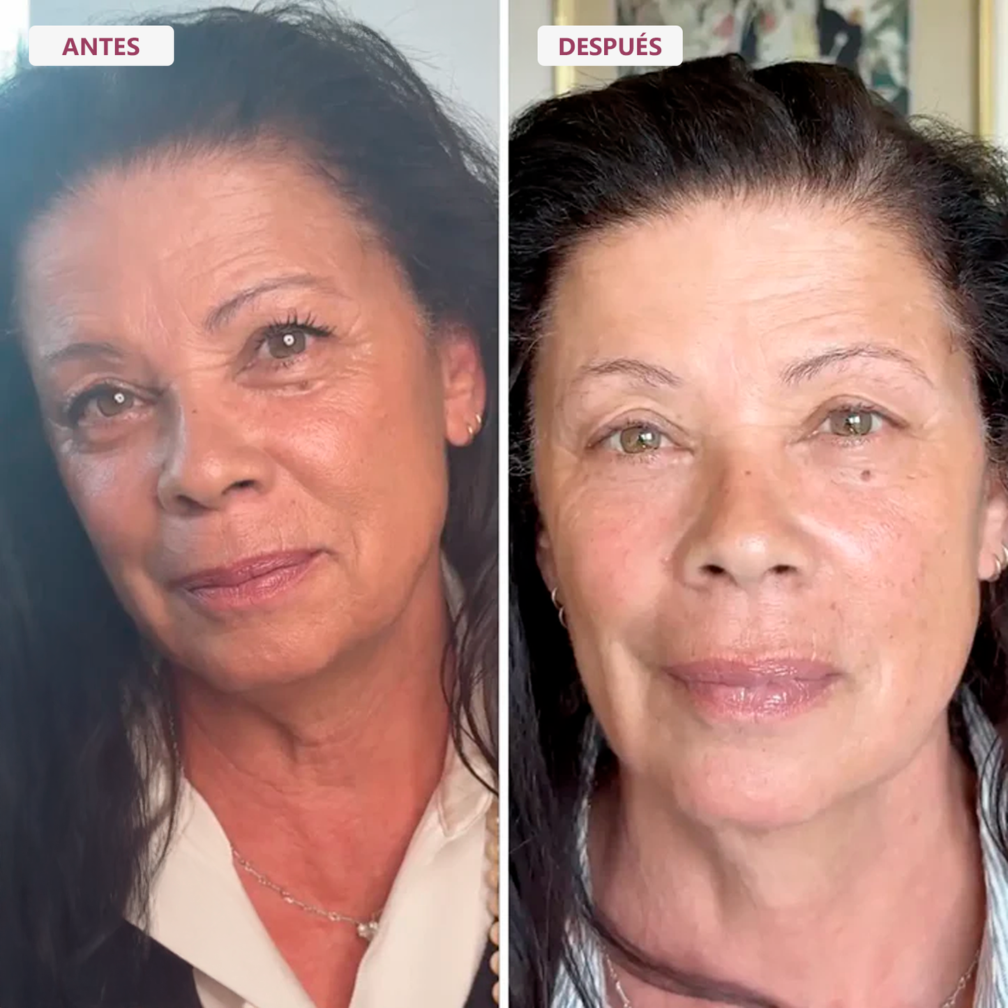 El Bálsamo Koreano Anti-Edad que Suaviza Líneas de Expresión al Contacto