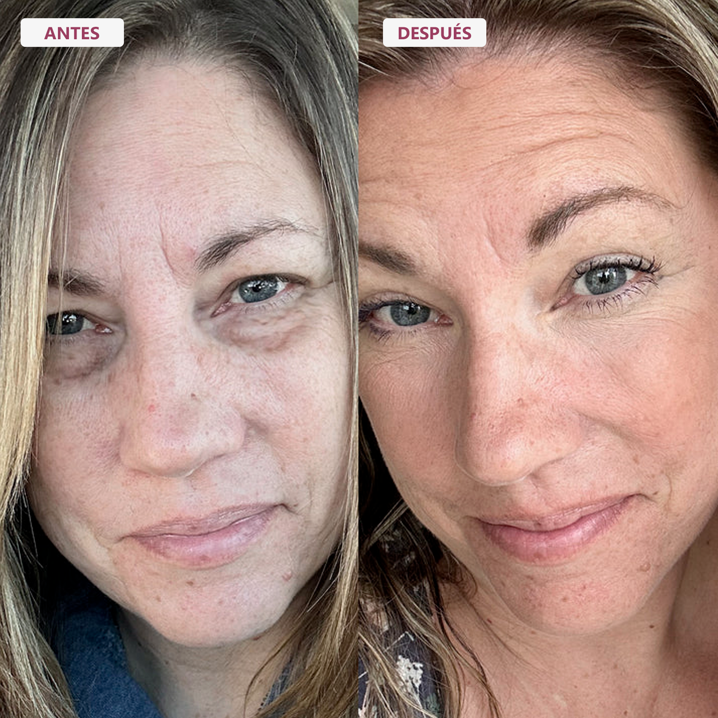 El Bálsamo Koreano Anti-Edad que Suaviza Líneas de Expresión al Contacto