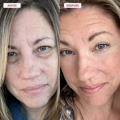 El Bálsamo Koreano Anti-Edad que Suaviza Líneas de Expresión al Contacto