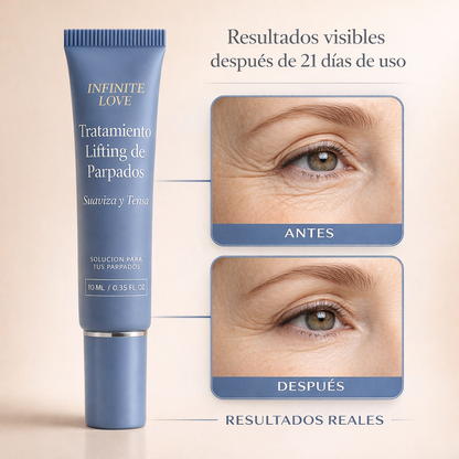 BioNature™ | Tratamiento de Levantamiento de Párpados