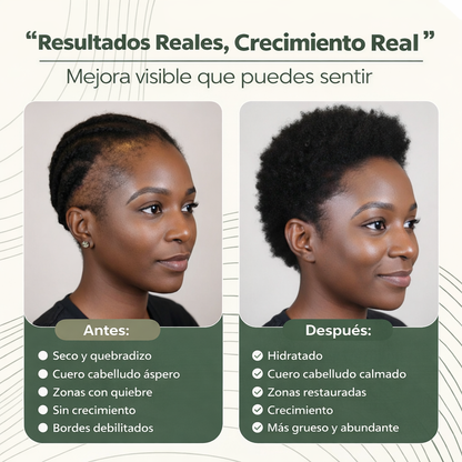 Aceite Natural para el Crecimiento Capilar de Batana