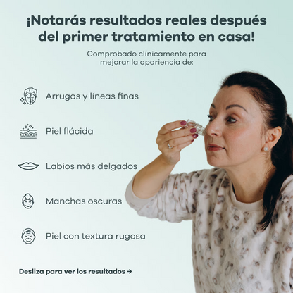 Sistema de Infusión con Microneedling™