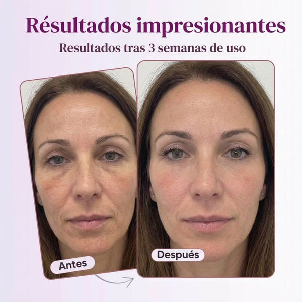 El Bálsamo Koreano Anti-Edad que Suaviza Líneas de Expresión al Contacto